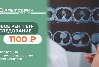 Рентген-исследование за 1100 ₽