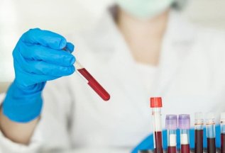 СКИДКА 10% на профиль анализов