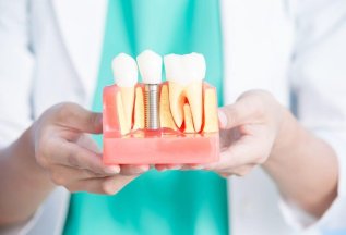 Имплантация от 28000 рублей