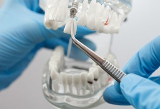 Установка импланта Dentium (Южная Корея) за 28 000 руб.
