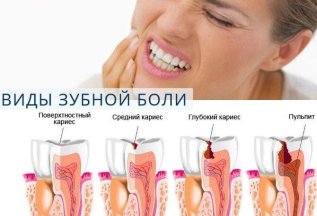 Лучшие цены на лечение зубов по острой боли