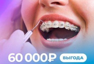 Скидка на элайнеры и брекеты 60000