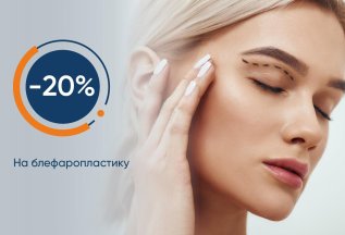 Скидка 20% на Блефаропластику!