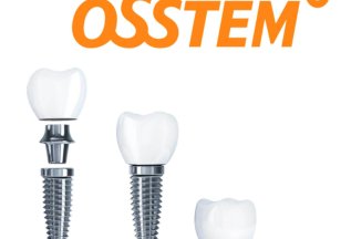 Имплантация зубов Osstem за 20 000 р.