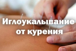 Избавим от курения иглоукалыванием