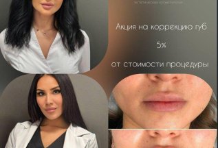 Акция на коррекцию губ
