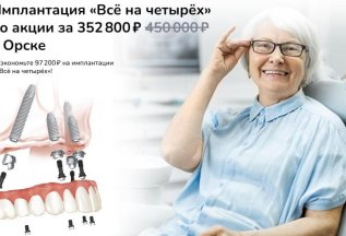 Преимущества имплантации «Всё на четырёх»