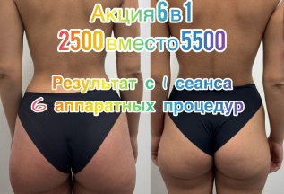 Комплекс 6 в 1 - 2500 рублей