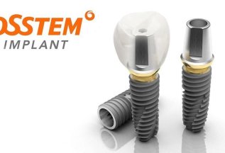 Имплант Osstem с установкой под ключ за 3630 руб/мес