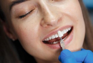 Восстановление зуба виниром E-max по специальной цене
