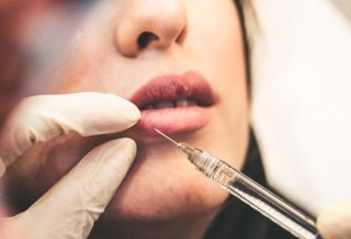Скидка на увеличение губ у врача-косметолога