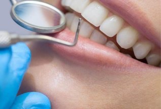Скидка 10% на лечение зубов