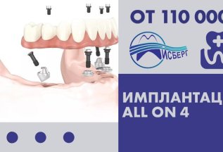 Протезирование all-on-4 от 110 000 рублей