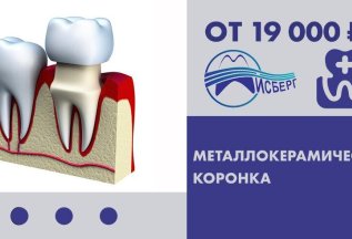 Металлокерамическая коронка от 19 000 рублей