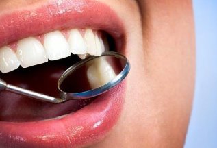 Бесплатный профосмотр у стоматолога до конца апреля