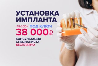 Имплантация зубов за 38 000 руб. вместо 48 200 руб.