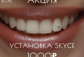 Скайсы по спеццене 1000 рублей до конца апреля