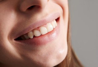 Протезирование зубов коронками со скидкой 5%