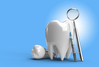 Скидка 30% на зубные импланты NOBEL