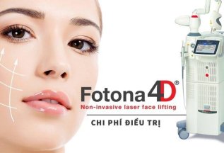 4D омоложение на аппарате Fotona со скидкой 40%