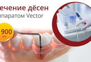 Лечение дёсен аппаратом Вектор (2 челюсти) - 9900₽