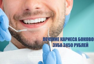 Лечение кариеса бокового зуба