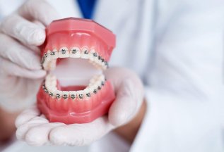 Консультация стоматолога — ортодонта - 500 руб.