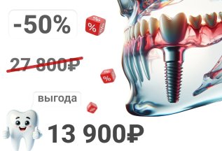 Имплантация зубов системы Alpha Bio (Израиль)