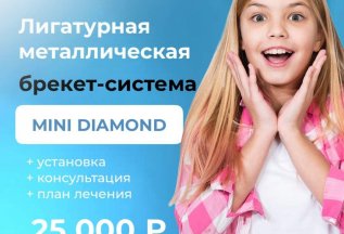 Брекет-система Mini Diamond с установкой за 25.000 ₽
