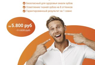 Отбеливание зубов за 5.800 руб (вместо 11.600 руб)
