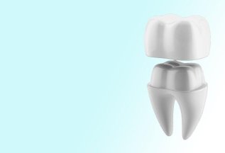 Скидки на стоматологические коронки до 13%