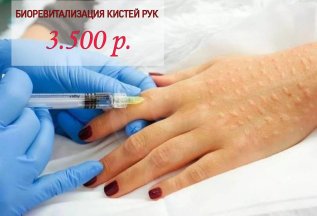 Биоревитализация кистей рук 3500 руб.