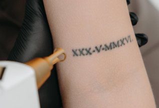 Удаление нежелательного татуажа всего за 3500Р