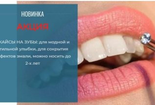 АКЦИЯ! НОВИНКА! Скайсы на зубы