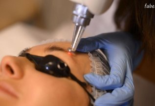 Удаление татуажа на пикосекундном лазере 