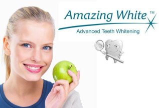 Отбеливание зубов системой «Amazing White» со скидкой 20%