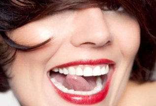 Пластика уздечки языка/губы лазером 4500 рублей!