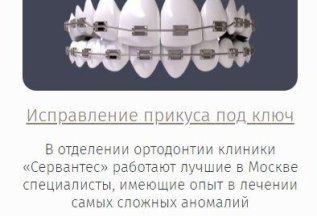 Исправление прикуса под ключ