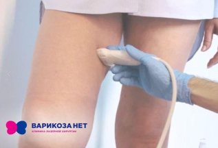 Если вы уже заметили у себя признаки варикоза— не медлите!