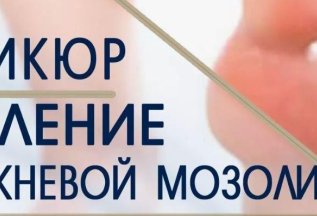 Удаление стержневой мозоли 1000 руб