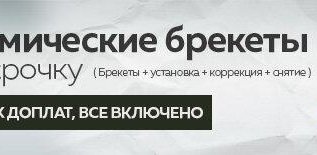 Керамические брекеты в рассрочку 5000 руб/мес*