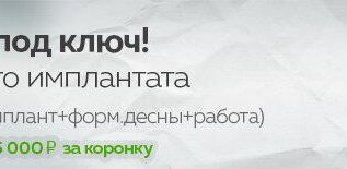 Имплантация под ключ 35000р ANKYLOS (Германия)