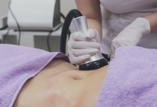 Уз-кавитация + RF лифтинг за 5000 рублей