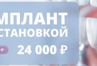 Имплант с установкой за 24000