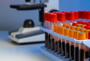 PRP CORTEXIL, при покупке абонемента