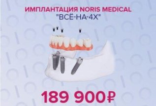 Имплантация Noris Medical 