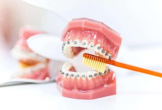 Профессиональная гигиена полости рта в счастливые за 6900 р