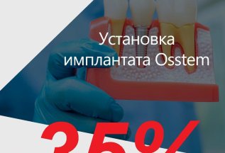 Имплант DIO с установкой по специальной цене 21900