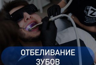 Отбеливание зубов за 10000 рублей