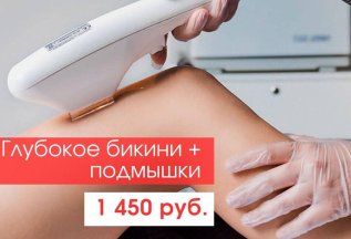 -50% на ЭЛОС-эпиляцию